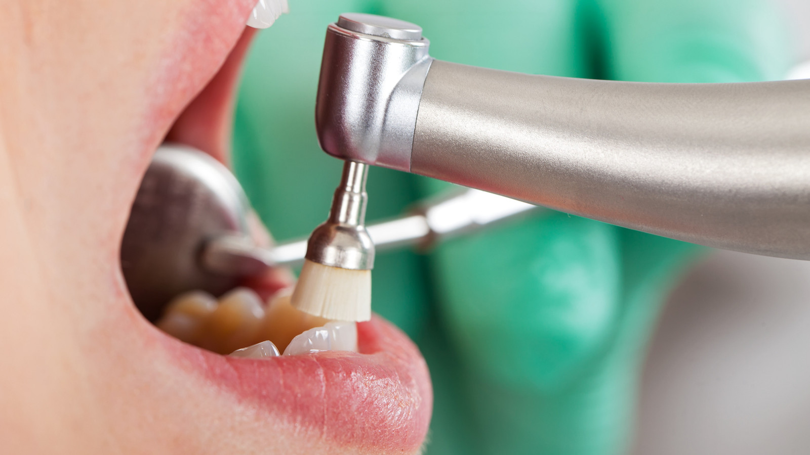 Odontologia preventiva